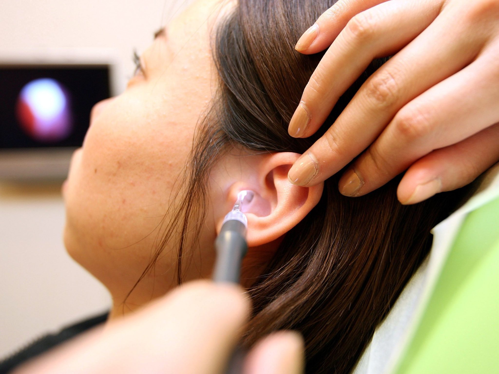 fire ear wax removal