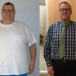 Gastric sleeve reviews