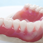dental implants in northern rivers