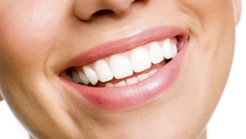 teeth whitening in Greensboro NC