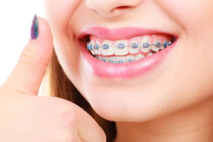 orthodontist services in Duncan