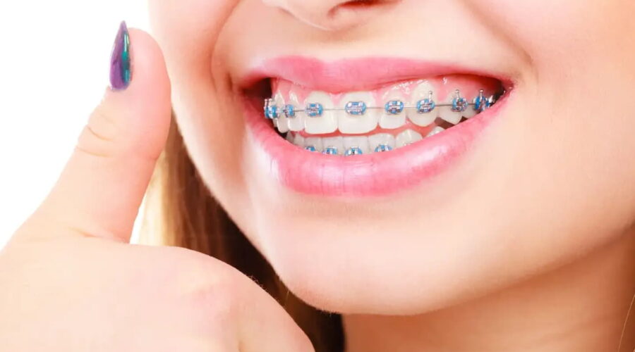 orthodontist services in Duncan