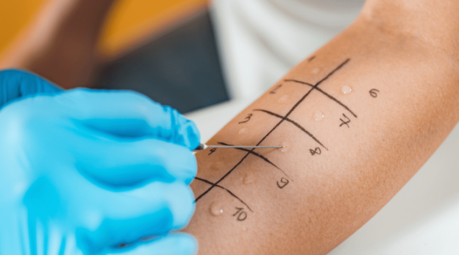 where to get a penicillin allergy test