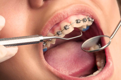 orthodontic treatment