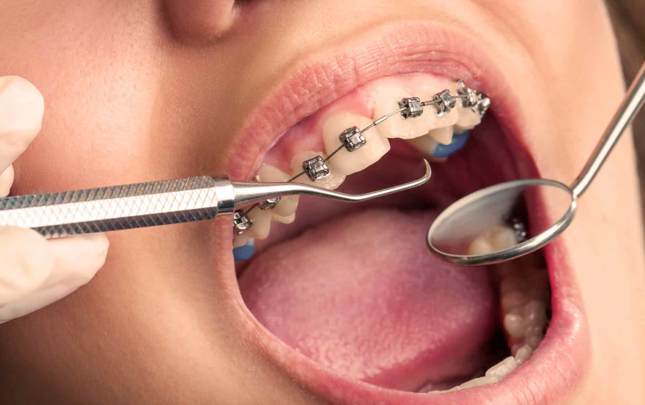 orthodontic treatment