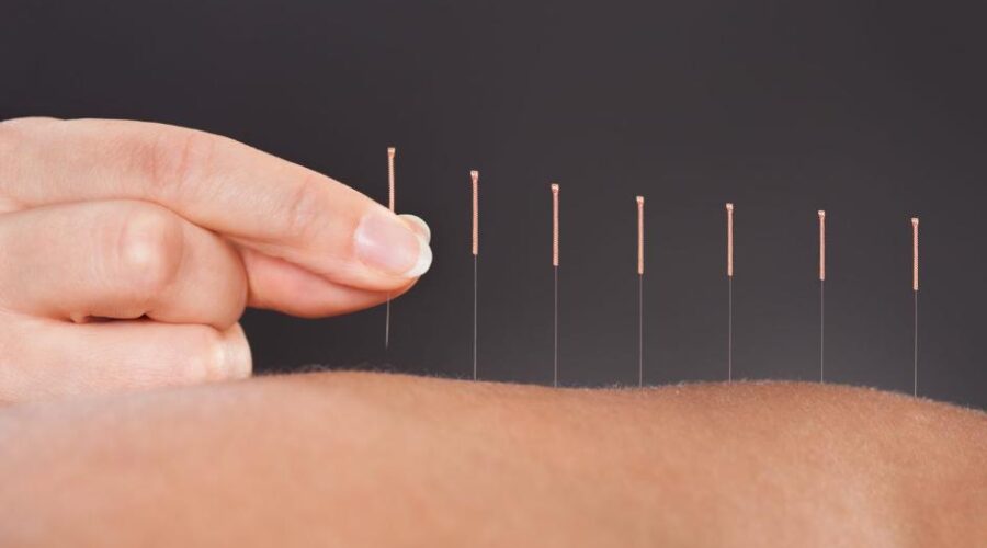 Chinese medicine and acupuncture